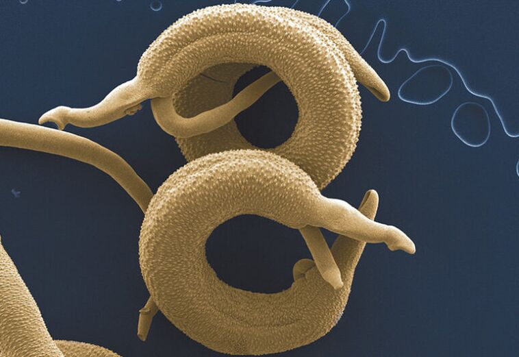 parazitai, gyvenantys žmogaus organizme