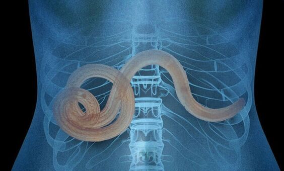 parazitas žmogaus organizme